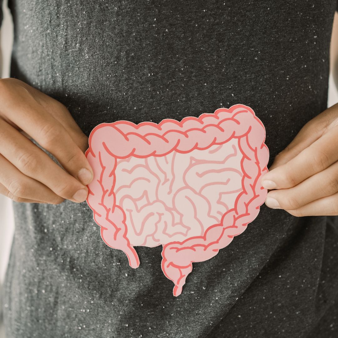 Diagram illustrating the gut&ndash;skin connection in PCOS PMOS